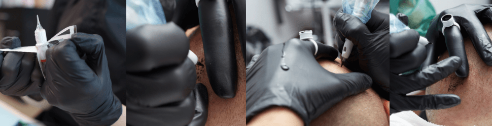 Micropigmentación capilar Madrid