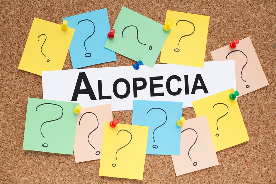 Alopecia